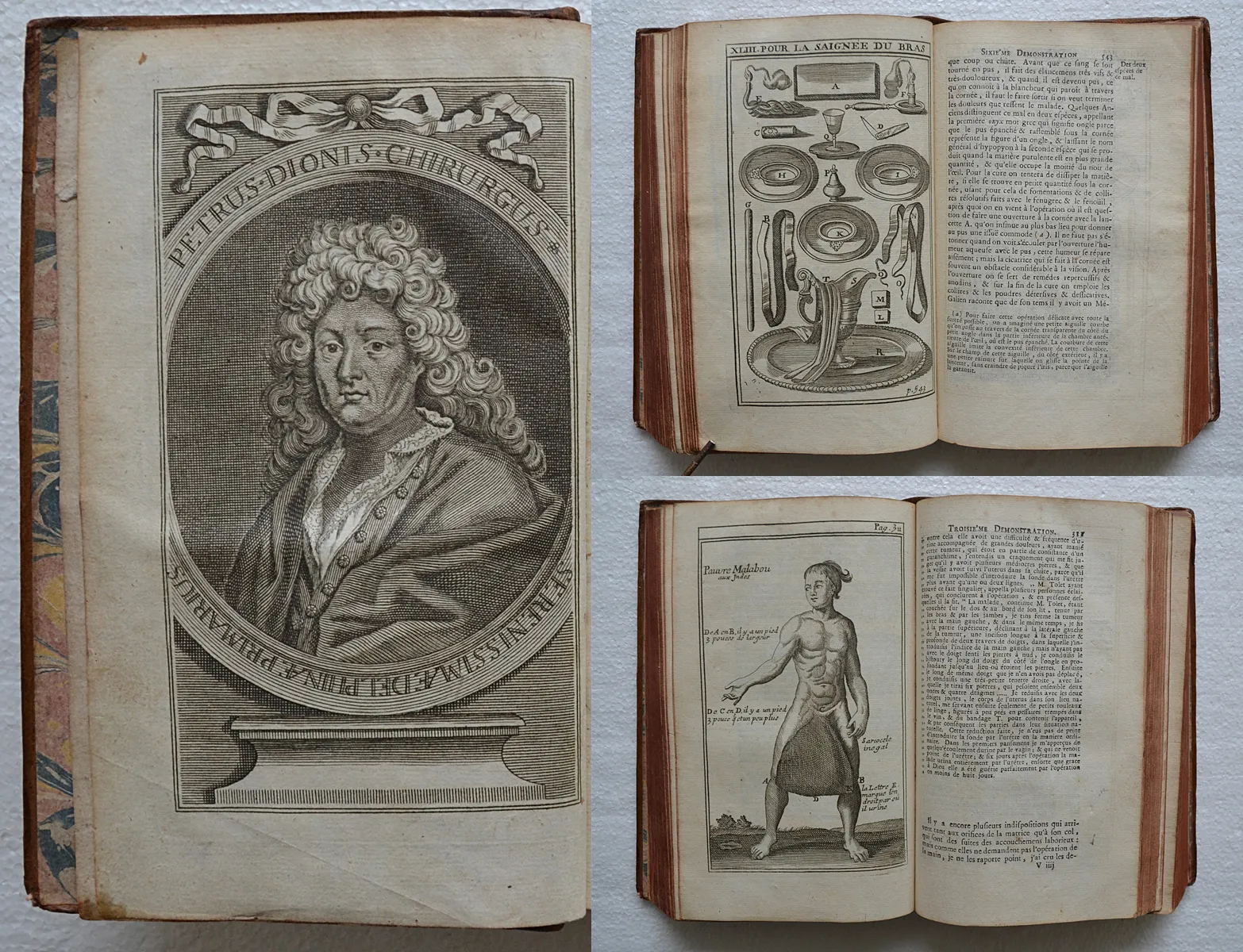 Cours d’opérations de chirurgie, démontrées au jardin-royal. (1/12) — DIONIS (Pierre), 1751 — Medecine