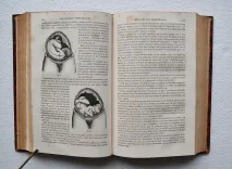 Dictionnaire encyclop (4/12) — DECHAMBRE (Amédée) / RAIGE-DELORME (Jacques) & LEREBOULLET (Léon), 1865 — Medecine
